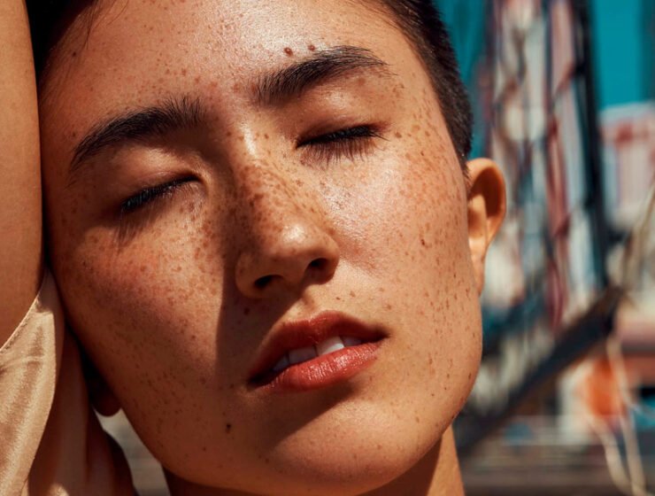 ¿Qué es la psoriasis y cómo controlarla?